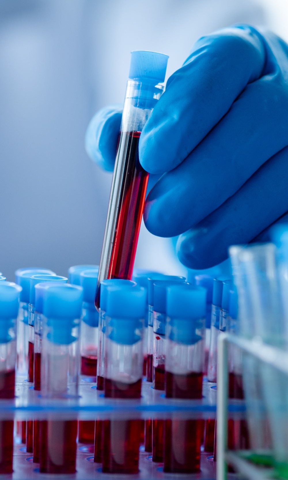 examen-sangre-clinica-familiar clinica familiar con pruebas de laboratorio de sangre